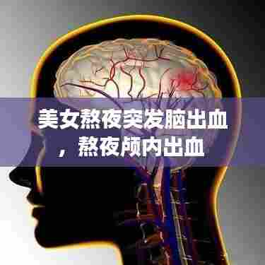 美女熬夜突发脑出血，熬夜颅内出血 