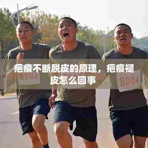 疤痕不断脱皮的原理，疤痕褪皮怎么回事 