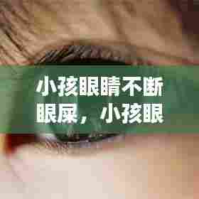小孩眼睛不断眼屎，小孩眼睛老是眼屎 