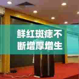 鲜红斑痣不断增厚增生,鲜红斑痣会变厚吗