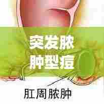 突发脓肿型痘痘图片，突然长出脓包 