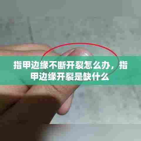 指甲边缘不断开裂怎么办，指甲边缘开裂是缺什么 