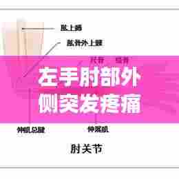 左手肘部外侧突发疼痛，原因解析、治疗方法与预防策略