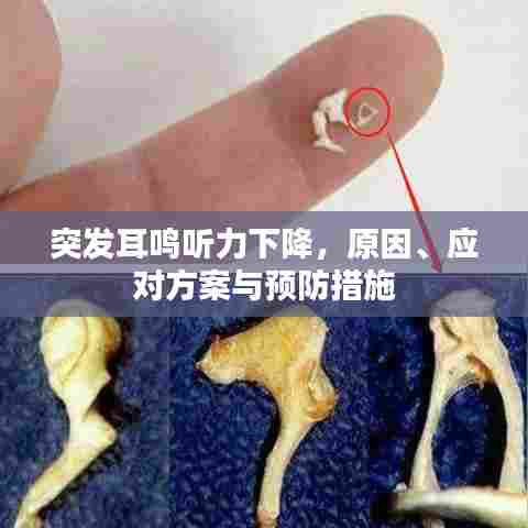 突发耳鸣听力下降,原因、应对方案与预防措施