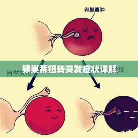 卵巢蒂扭转突发症状详解