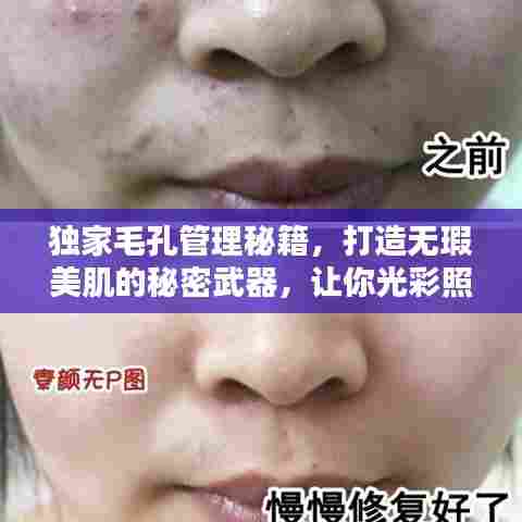 独家毛孔管理秘籍，打造无瑕美肌的秘密武器，让你光彩照人！