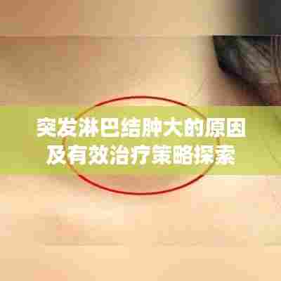 突发淋巴结肿大的原因及有效治疗策略探索