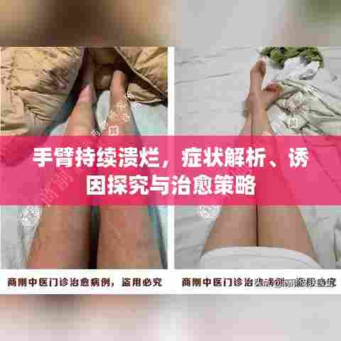 手臂持续溃烂，症状解析、诱因探究与治愈策略