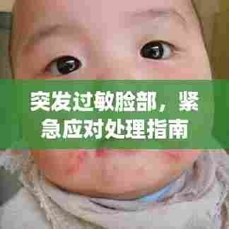 突发过敏脸部，紧急应对处理指南！