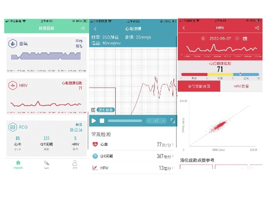 手环固件版本,深度应用策略数据_VR_v4.320